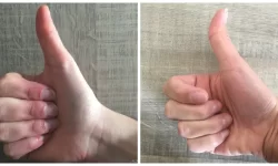 انگشت شست تان راست است یا کج؟ این چه چیزی در مورد شخصیت شما به شما میگوید!‏